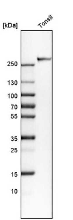 CD35 Antibody, Novus Biologicals 25 &mu;L, Unlabeled:Antibodies, Polyclonal